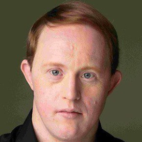 Chris Burke